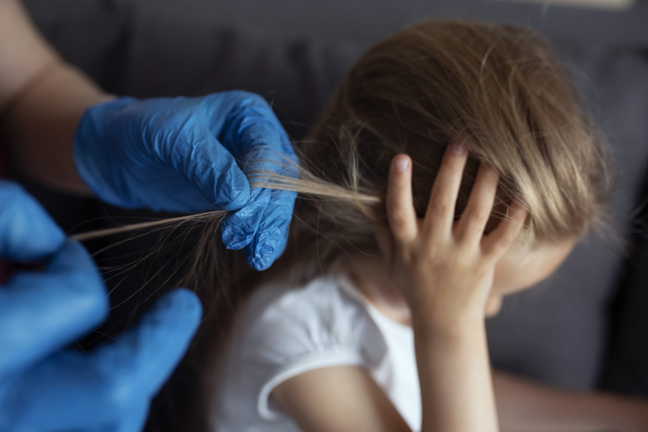 Back to School: How to Treat Head Lice