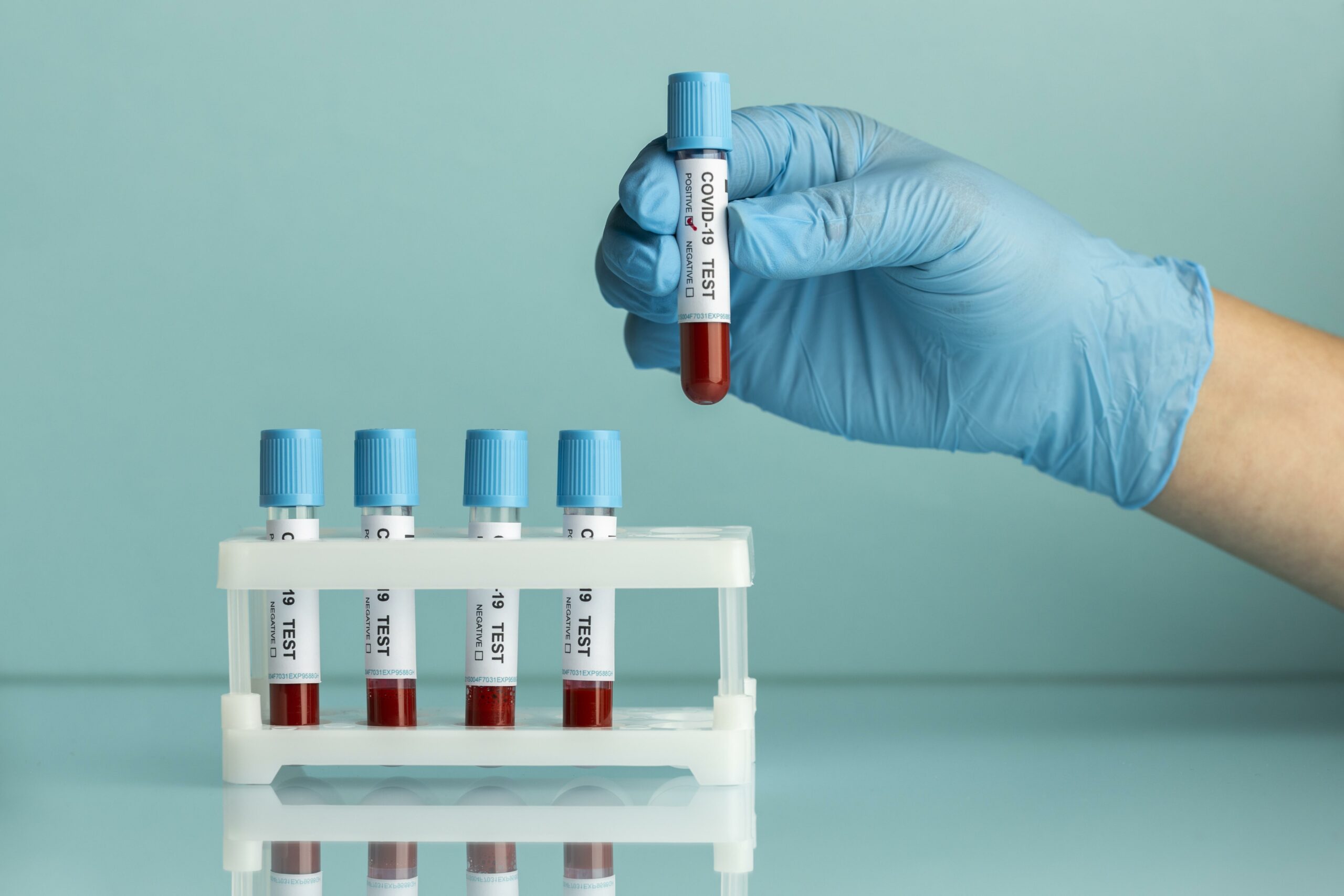 5 Ways a General Profile Blood Test Can Help You